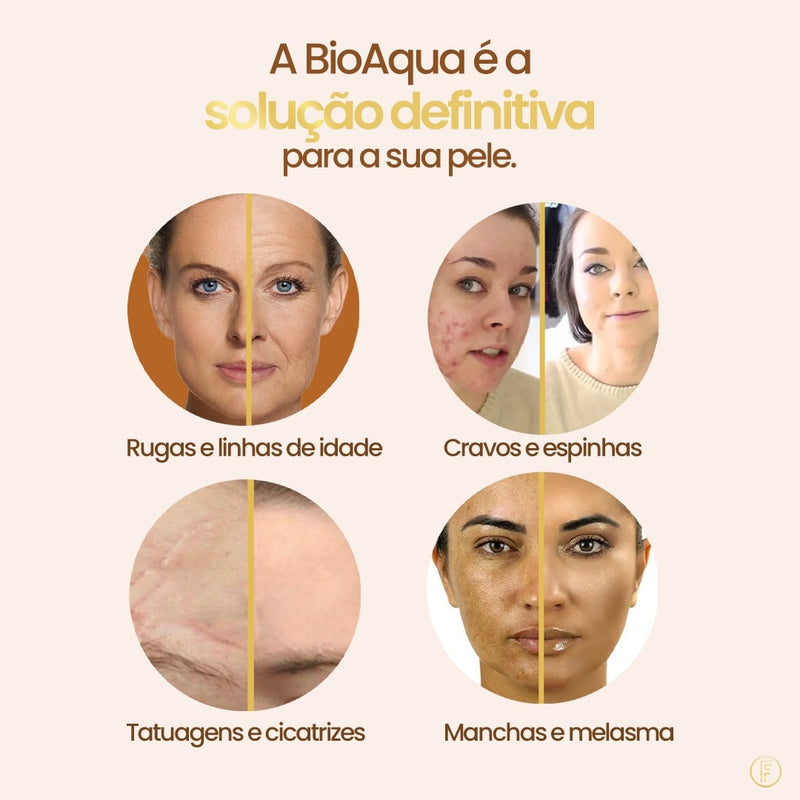 Base Profissional - BioAqua™ (COMPRE 1 & LEVE 2) + Brindes