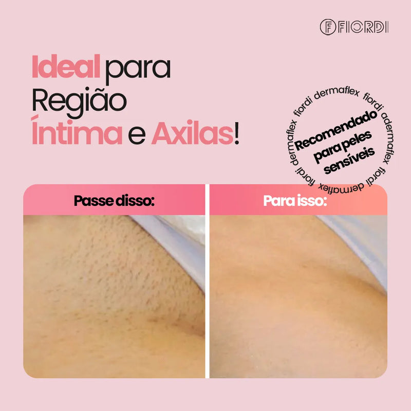 Depilador Elétrico 4 em 1 - DermaFlex® [Edição Limitada]