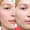 Creme Corretivo - Centella Cream™